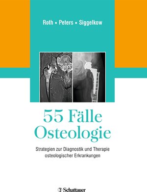 Buchcover 55 Fälle Osteologie  | EAN 9783132425347 | ISBN 3-13-242534-6 | ISBN 978-3-13-242534-7