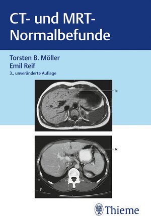 Buchcover CT und MRT Normalbefunde | Torsten Bert Möller | EAN 9783132453081 | ISBN 3-13-245308-0 | ISBN 978-3-13-245308-1