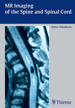Buchcover MR Imaging of the Spine and Spinal Cord | Detlev Uhlenbrock | EAN 9783132578166 | ISBN 3-13-257816-9 | ISBN 978-3-13-257816-6