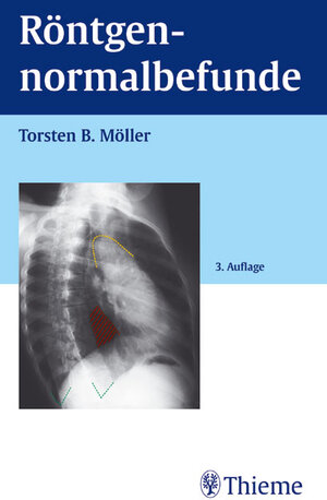 Buchcover Röntgennormalbefunde | Torsten B Möller | EAN 9783137009030 | ISBN 3-13-700903-0 | ISBN 978-3-13-700903-0