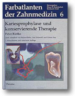 Buchcover Band 6: Kariesprophylaxe und konservierende Therapie | Peter Riethe | EAN 9783137147022 | ISBN 3-13-714702-6 | ISBN 978-3-13-714702-2