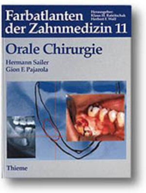 Farbatlanten der Zahnmedizin, Bd.11, Orale Chirurgie