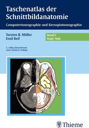 Taschenatlas der Schnittbildanatomie 1. Kopf, Hals: Computertomographie und Kernspintomographie