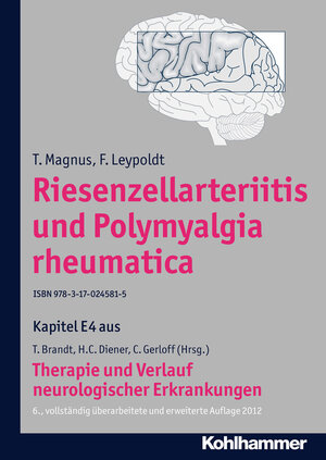 Buchcover Riesenzellarteritis und Polymyalgia rheumatica | T. Magnus | EAN 9783170244696 | ISBN 3-17-024469-8 | ISBN 978-3-17-024469-6