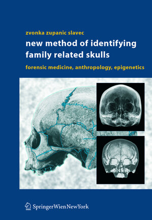 Buchcover New Method of Identifying Family Related Skulls | Zvonka Zupanic Slavec | EAN 9783211220443 | ISBN 3-211-22044-5 | ISBN 978-3-211-22044-3