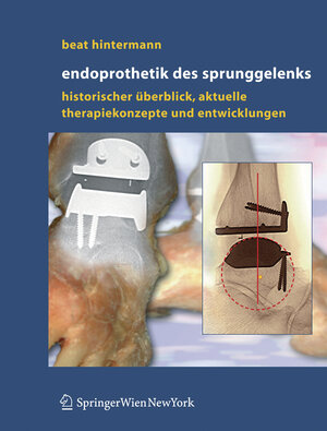 Buchcover Endoprothetik des Sprunggelenks | Beat Hintermann | EAN 9783211235867 | ISBN 3-211-23586-8 | ISBN 978-3-211-23586-7