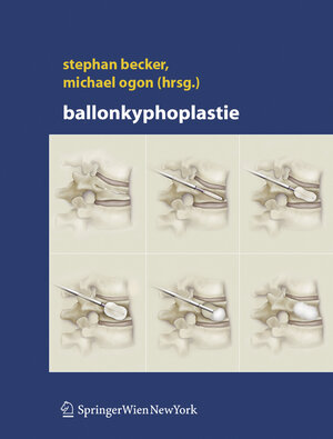 Buchcover Ballonkyphoplastie  | EAN 9783211235928 | ISBN 3-211-23592-2 | ISBN 978-3-211-23592-8