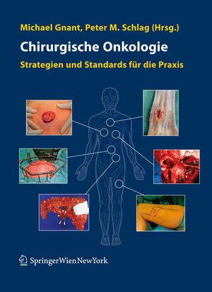 Buchcover Chirurgische Onkologie  | EAN 9783211486122 | ISBN 3-211-48612-7 | ISBN 978-3-211-48612-2