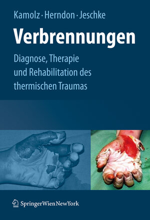 Buchcover Verbrennungen  | EAN 9783211798959 | ISBN 3-211-79895-1 | ISBN 978-3-211-79895-9