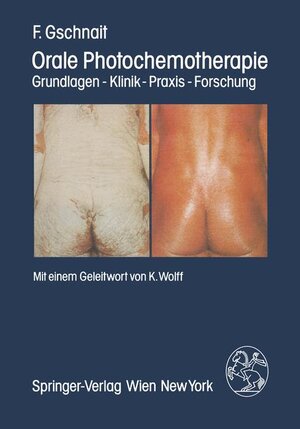 Buchcover Orale Photochemotherapie | F. Gschnait | EAN 9783211817025 | ISBN 3-211-81702-6 | ISBN 978-3-211-81702-5