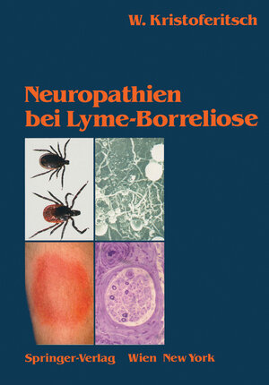 Buchcover Neuropathien bei Lyme-Borreliose | Wolfgang Kristoferitsch | EAN 9783211821084 | ISBN 3-211-82108-2 | ISBN 978-3-211-82108-4