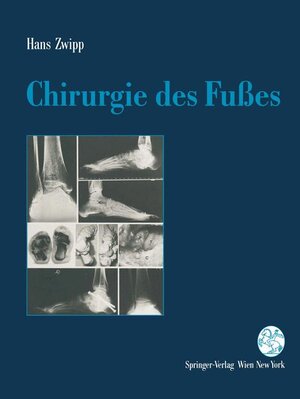 Buchcover Chirurgie des Fußes | Hans Zwipp | EAN 9783211824115 | ISBN 3-211-82411-1 | ISBN 978-3-211-82411-5