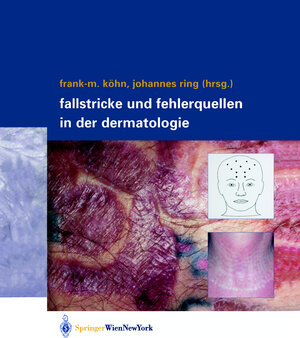 Buchcover Fallstricke und Fehlerquellen in der Dermatologie  | EAN 9783211838174 | ISBN 3-211-83817-1 | ISBN 978-3-211-83817-4