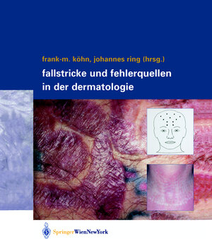 Fallstricke und Fehlerquellen in der Dermatologie