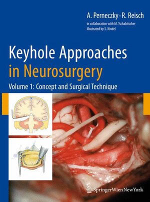 Buchcover Keyhole Approaches in Neurosurgery | Axel Perneczky | EAN 9783211838853 | ISBN 3-211-83885-6 | ISBN 978-3-211-83885-3