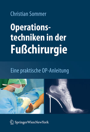 Buchcover Operationstechniken in der Fußchirurgie | Christian Sommer | EAN 9783211994238 | ISBN 3-211-99423-8 | ISBN 978-3-211-99423-8