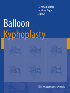 Buchcover Balloon Kyphoplasty  | EAN 9783211999080 | ISBN 3-211-99908-6 | ISBN 978-3-211-99908-0