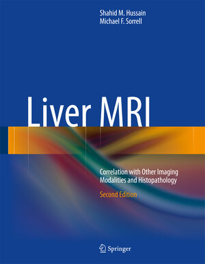 Buchcover Liver MRI | Shahid M. Hussain | EAN 9783319060033 | ISBN 3-319-06003-1 | ISBN 978-3-319-06003-3