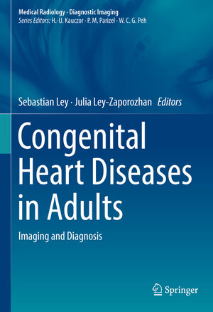 Buchcover Congenital Heart Diseases in Adults  | EAN 9783319618883 | ISBN 3-319-61888-1 | ISBN 978-3-319-61888-3