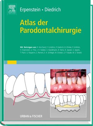 Atlas der Parodontalchirurgie