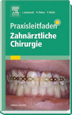 Buchcover Praxisleitfaden Zahnärztliche Chirurgie | Jochen Jackowski | EAN 9783437055409 | ISBN 3-437-05540-2 | ISBN 978-3-437-05540-9