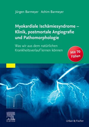 Buchcover Myokardiale Ischämiesyndrome - Klinik, postmortale Angiografie und Pathomorphologie | Achim Barmeyer | EAN 9783437213021 | ISBN 3-437-21302-4 | ISBN 978-3-437-21302-1
