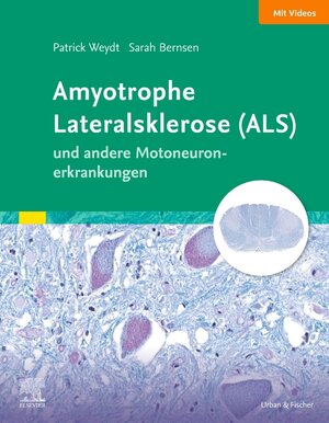Buchcover Amyotrophe Lateralsklerose (ALS) und andere Motoneuronerkrankungen | Patrick Weydt | EAN 9783437217814 | ISBN 3-437-21781-X | ISBN 978-3-437-21781-4