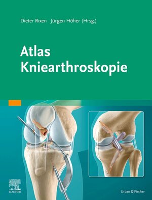 Buchcover Atlas Kniearthroskopie | EAN 9783437227721 | ISBN 3-437-22772-6 | ISBN 978-3-437-22772-1