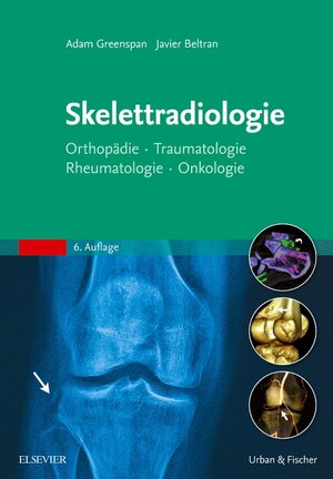 Buchcover Skelettradiologie | Adam Greenspan | EAN 9783437230646 | ISBN 3-437-23064-6 | ISBN 978-3-437-23064-6