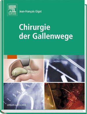 Buchcover Chirurgie der Gallenwege  | EAN 9783437243004 | ISBN 3-437-24300-4 | ISBN 978-3-437-24300-4