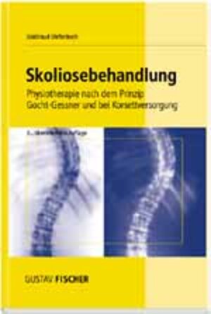 Skoliosebehandlung: Physiotherapie nach dem Prinzip Gocht-Gessner und bei Korsettversorgung