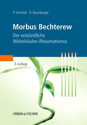 Morbus Bechterew: Der entzündliche Wirbelsäulen-Rheumatismus