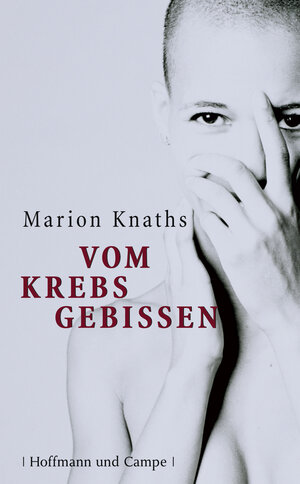 Vom Krebs gebissen