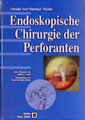 Buchcover Endoskopische Chirurgie der Perforanten | Claudio Duff | EAN 9783456831442 | ISBN 3-456-83144-7 | ISBN 978-3-456-83144-2