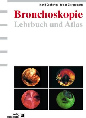 Buchcover Lehrbuch und Atlas der Bronchoskopie | Ingrid Dobbertin | EAN 9783456840604 | ISBN 3-456-84060-8 | ISBN 978-3-456-84060-4