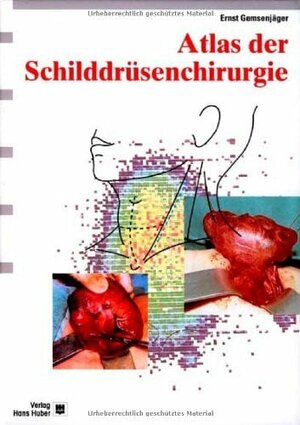 Atlas der Schilddrüsenchirurgie: Ein chirurgisch-klinisches Lehrbuch