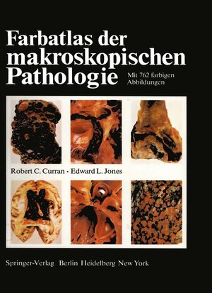 Buchcover Farbatlas der makroskopischen Pathologie | R. C. Curran | EAN 9783540076438 | ISBN 3-540-07643-3 | ISBN 978-3-540-07643-8