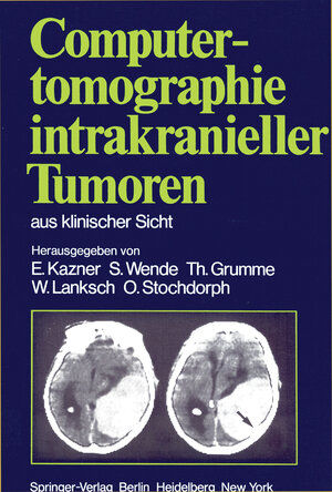 Buchcover Computertomographie intrakranieller Tumoren aus klinischer Sicht  | EAN 9783540105404 | ISBN 3-540-10540-9 | ISBN 978-3-540-10540-4