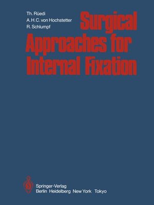 Buchcover Surgical Approaches for Internal Fixation | Thomas Rüedi | EAN 9783540128090 | ISBN 3-540-12809-3 | ISBN 978-3-540-12809-0