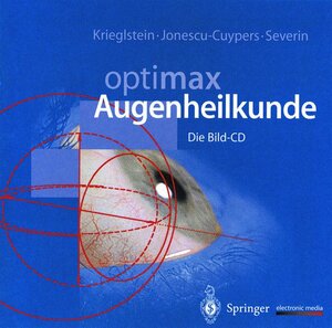 Buchcover Optimax Augenheilkunde | Günter K. Krieglstein | EAN 9783540146995 | ISBN 3-540-14699-7 | ISBN 978-3-540-14699-5