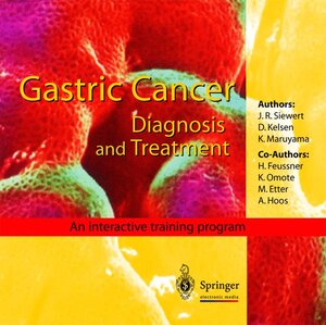 Buchcover Gastric Cancer | J.R. Siewert | EAN 9783540147879 | ISBN 3-540-14787-X | ISBN 978-3-540-14787-9