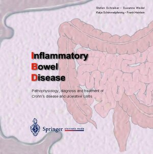Buchcover Inflammatory Bowel Disease | Stefan Schreiber | EAN 9783540148166 | ISBN 3-540-14816-7 | ISBN 978-3-540-14816-6