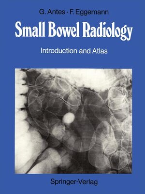 Buchcover Small Bowel Radiology | Günther Antes | EAN 9783540152637 | ISBN 3-540-15263-6 | ISBN 978-3-540-15263-7