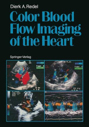 Buchcover Color Blood Flow Imaging of the Heart | Dierk A. Redel | EAN 9783540165217 | ISBN 3-540-16521-5 | ISBN 978-3-540-16521-7