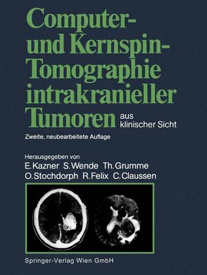 Buchcover Computer- und Kernspin-Tomographie intrakranieller Tumoren aus klinischer Sicht  | EAN 9783540182832 | ISBN 3-540-18283-7 | ISBN 978-3-540-18283-2