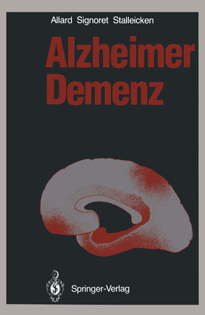 Buchcover Alzheimer Demenz | Michael Allard | EAN 9783540182856 | ISBN 3-540-18285-3 | ISBN 978-3-540-18285-6