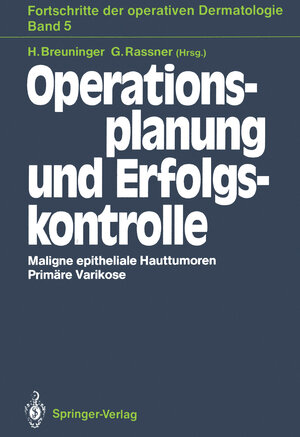 Buchcover Operationsplanung und Erfolgskontrolle  | EAN 9783540193227 | ISBN 3-540-19322-7 | ISBN 978-3-540-19322-7