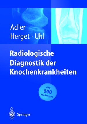 Buchcover Radiologische Diagnostik der Knochenkrankheiten | Claus-Peter Adler | EAN 9783540204657 | ISBN 3-540-20465-2 | ISBN 978-3-540-20465-7