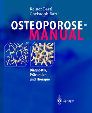 Osteoporose-Manual: Diagnostik, Prävention und Therapie