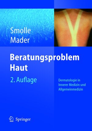 Buchcover Beratungsproblem Haut | Josef Smolle | EAN 9783540211853 | ISBN 3-540-21185-3 | ISBN 978-3-540-21185-3